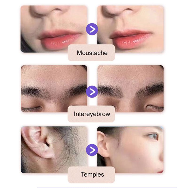 🔥Buy 2 Get 1 Free🔥Gentle and Painless Facial Hair Removal Cream - Image 6