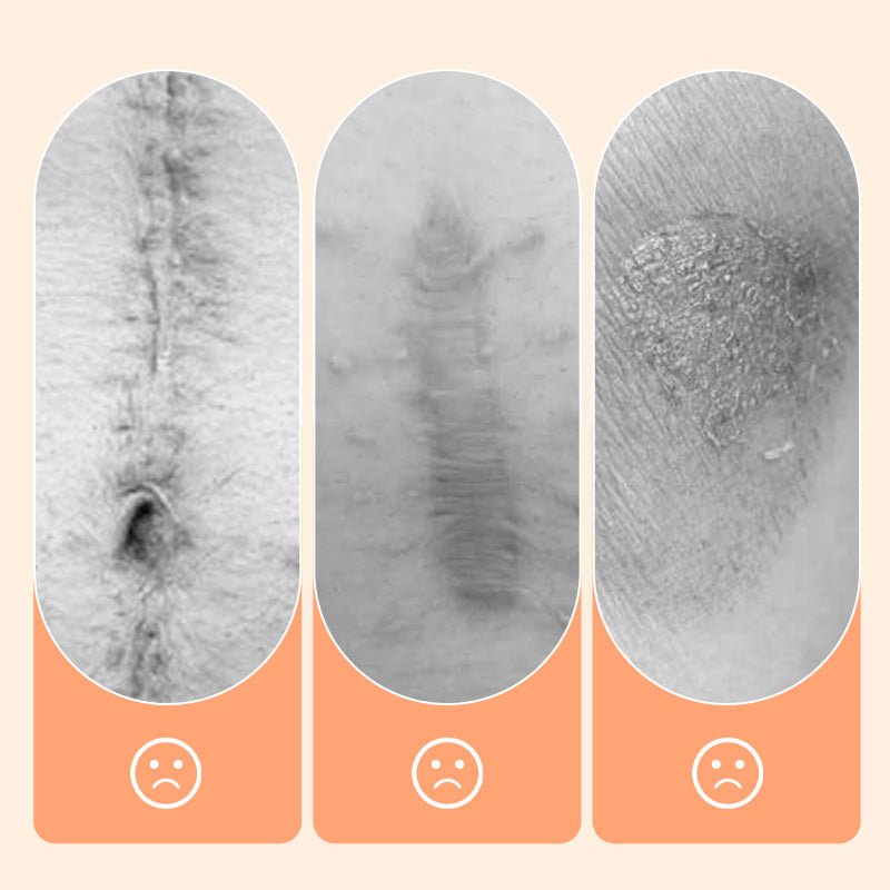 💦✨ Reusable waterproof silicone scar patch! Making scars invisible is not a dream ✨💦! - Image 4