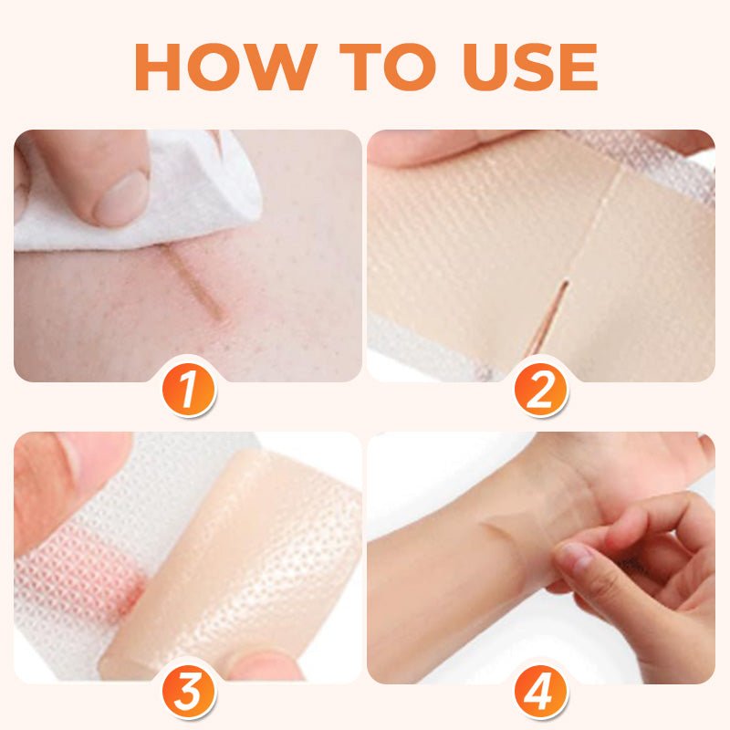 💦✨ Reusable waterproof silicone scar patch! Making scars invisible is not a dream ✨💦! - Image 8